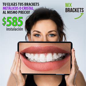MX Brackets